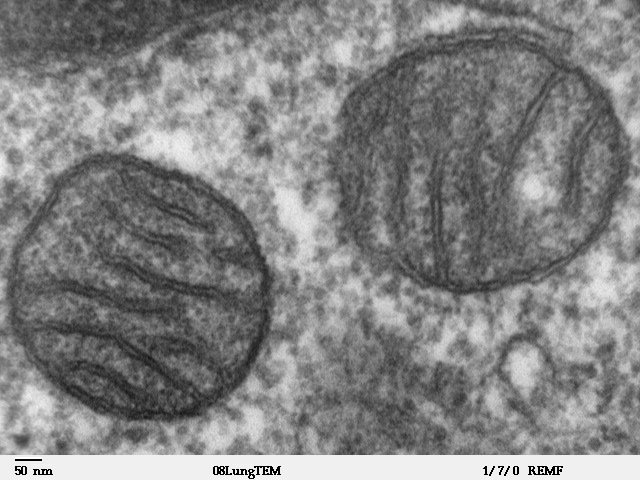 Sezione di due mitocondri (tubulari) osservati tramite microfotografia elettronica a trasmissione.