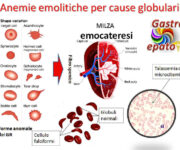 le-anemie-emolitiche-congenite-da-alterazioni-della-membrana-eritrocitaria-sferocitosi-ellissocitosi-e-stomatocitosi