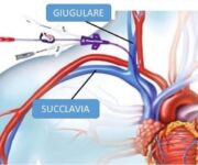 Cateteri-venosi-non-tunnelizzati-1024×576